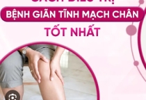 KHÓA HỌC XBBH - VLTL trị suy giãn tĩnh mạch, nông sâu vùng chân