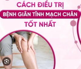 KHÓA HỌC XBBH - VLTL trị suy giãn tĩnh mạch, nông sâu vùng chân